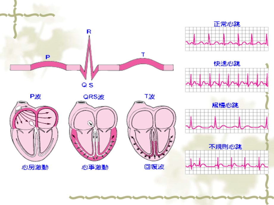 《读懂心电图》PPT课件.ppt_第3页