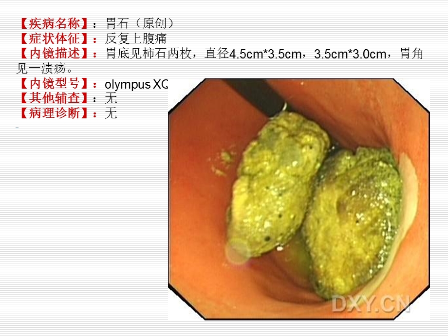 《消化内镜》PPT课件.ppt_第2页