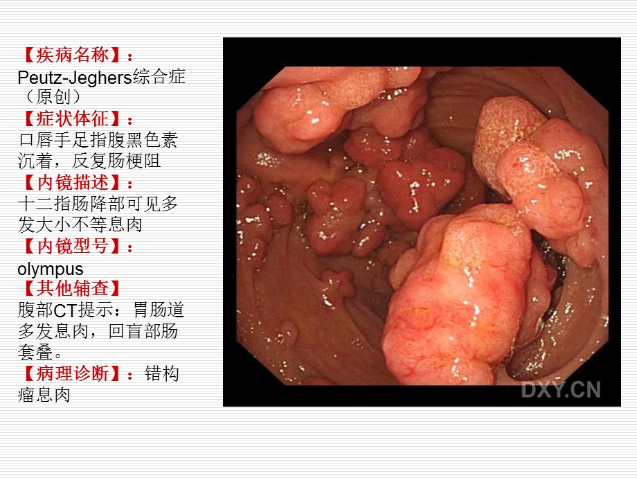 《消化内镜》PPT课件.ppt_第3页