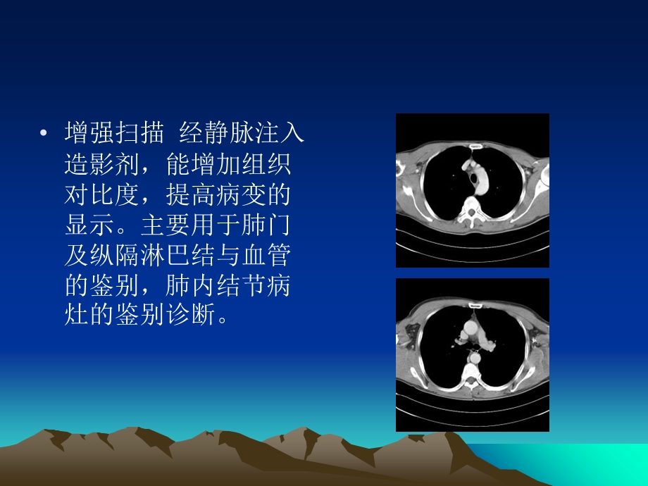 《胸部正常CT解剖》PPT课件.ppt_第3页