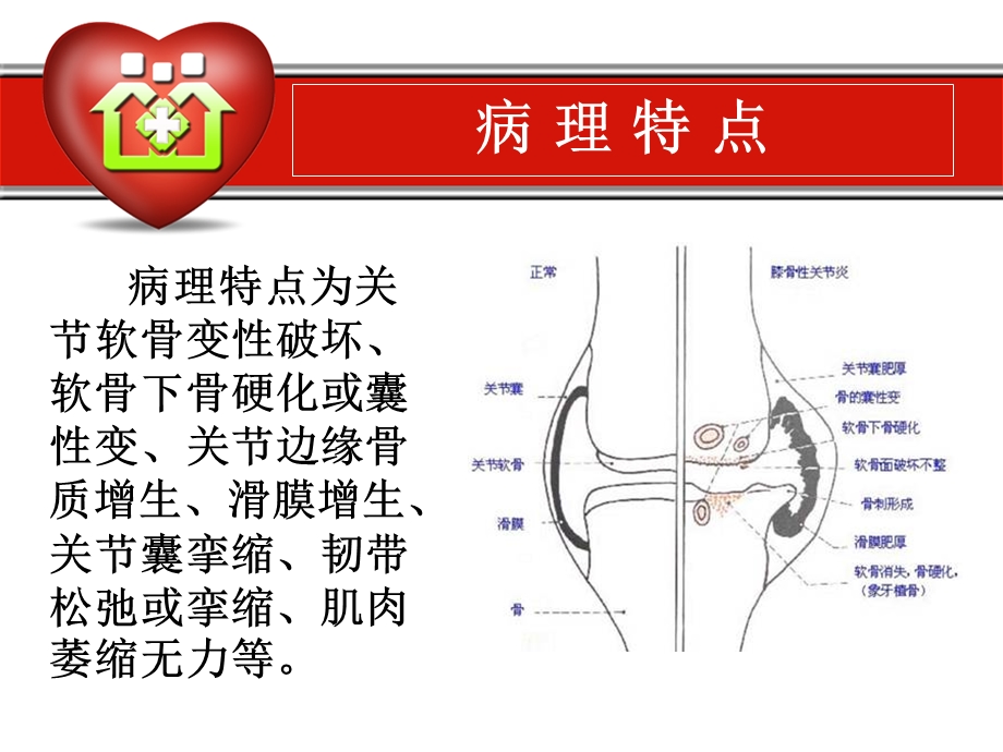 《骨性关节炎的康复》PPT课件.ppt_第3页