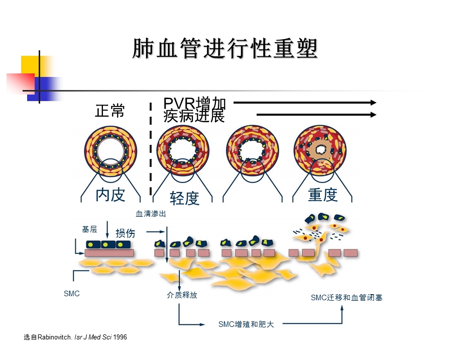 肺动脉高压靶向药物治疗的中国证据.ppt_第3页