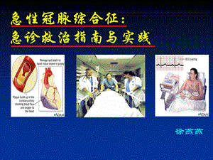 acs急诊指南与实践.ppt