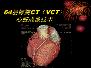 64排螺旋CT心脏成像技术08123.ppt