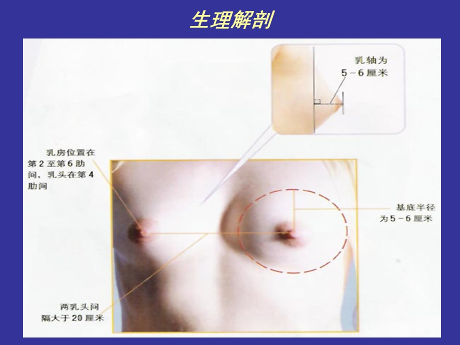 乳房疾病概述.ppt_第2页