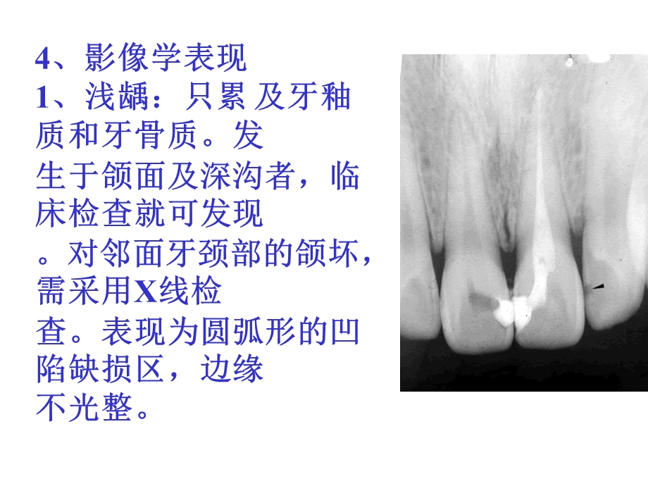 口腔颌面常见病诊断.ppt_第3页