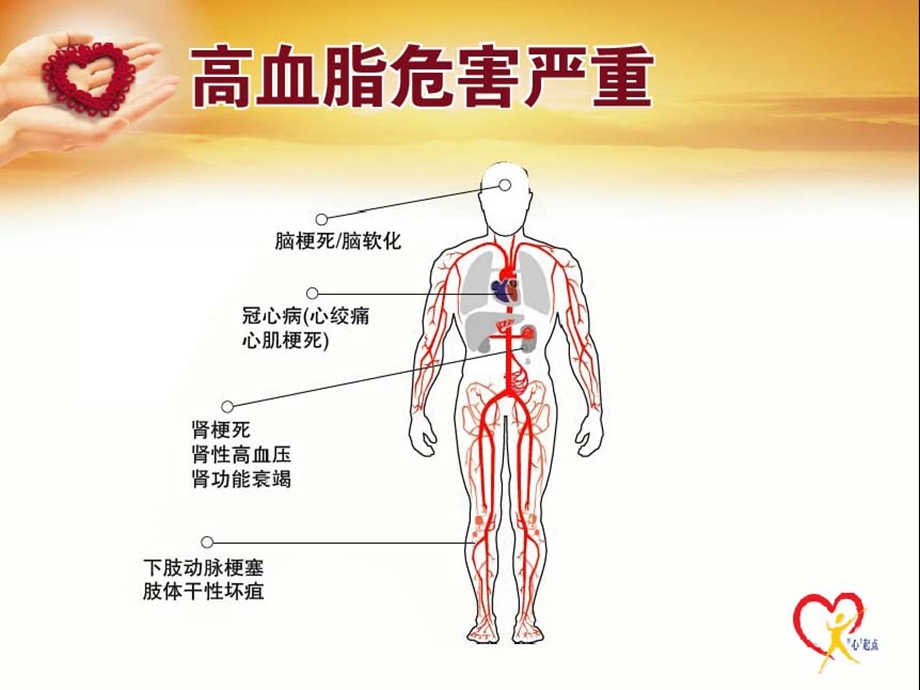 让我们一起轻松学习血脂.ppt_第3页