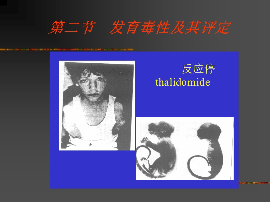 【教学课件】第九章发育毒性与致畸作用.ppt_第3页