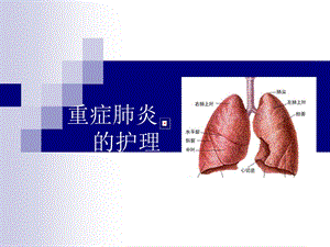 《重症肺炎的护理》PPT课件.ppt