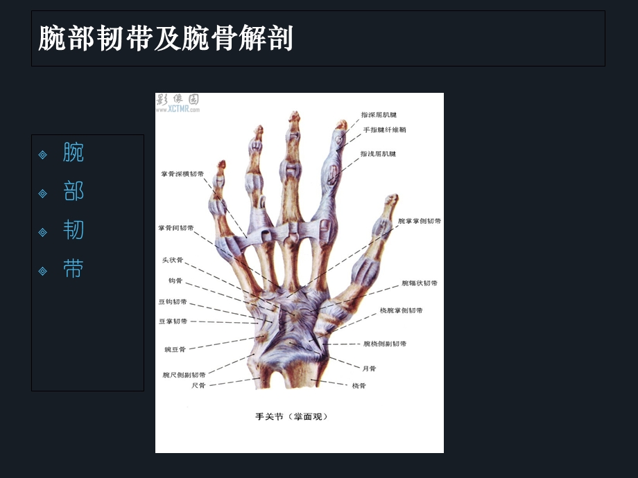 《腕骨脱位》PPT课件.ppt_第3页