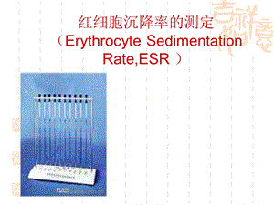 红细胞沉降率的测定ErythrocyteSedimentationRateESR.ppt