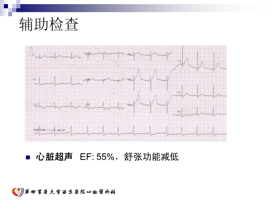 经桡动脉处理大血管小支架术后再狭窄.ppt_第3页