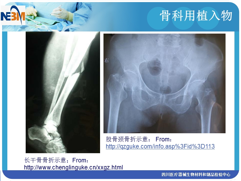 骨科用植入物评价技术简介.PPT_第2页