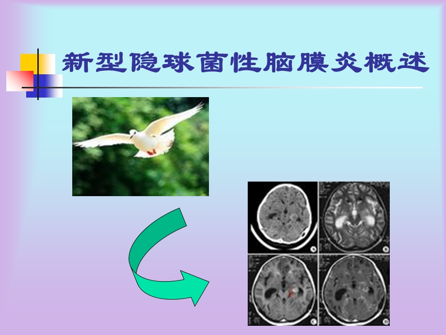 《隐脑的护理》PPT课件.ppt_第2页