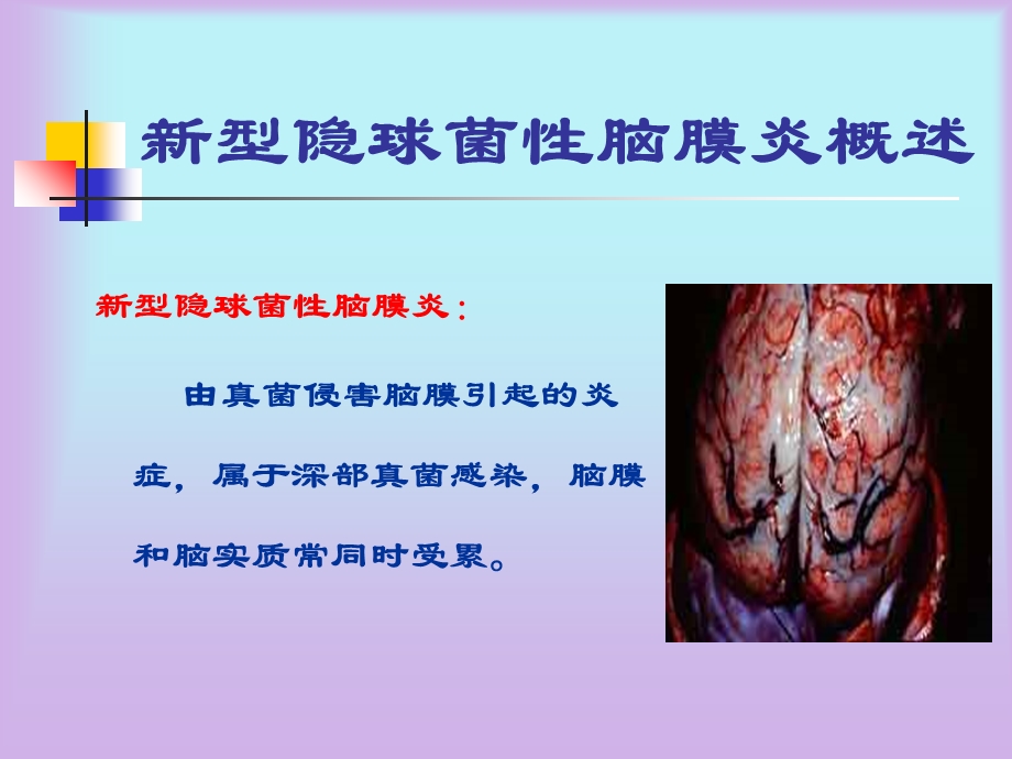 《隐脑的护理》PPT课件.ppt_第3页