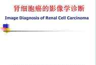 《肾癌影像学》PPT课件.ppt