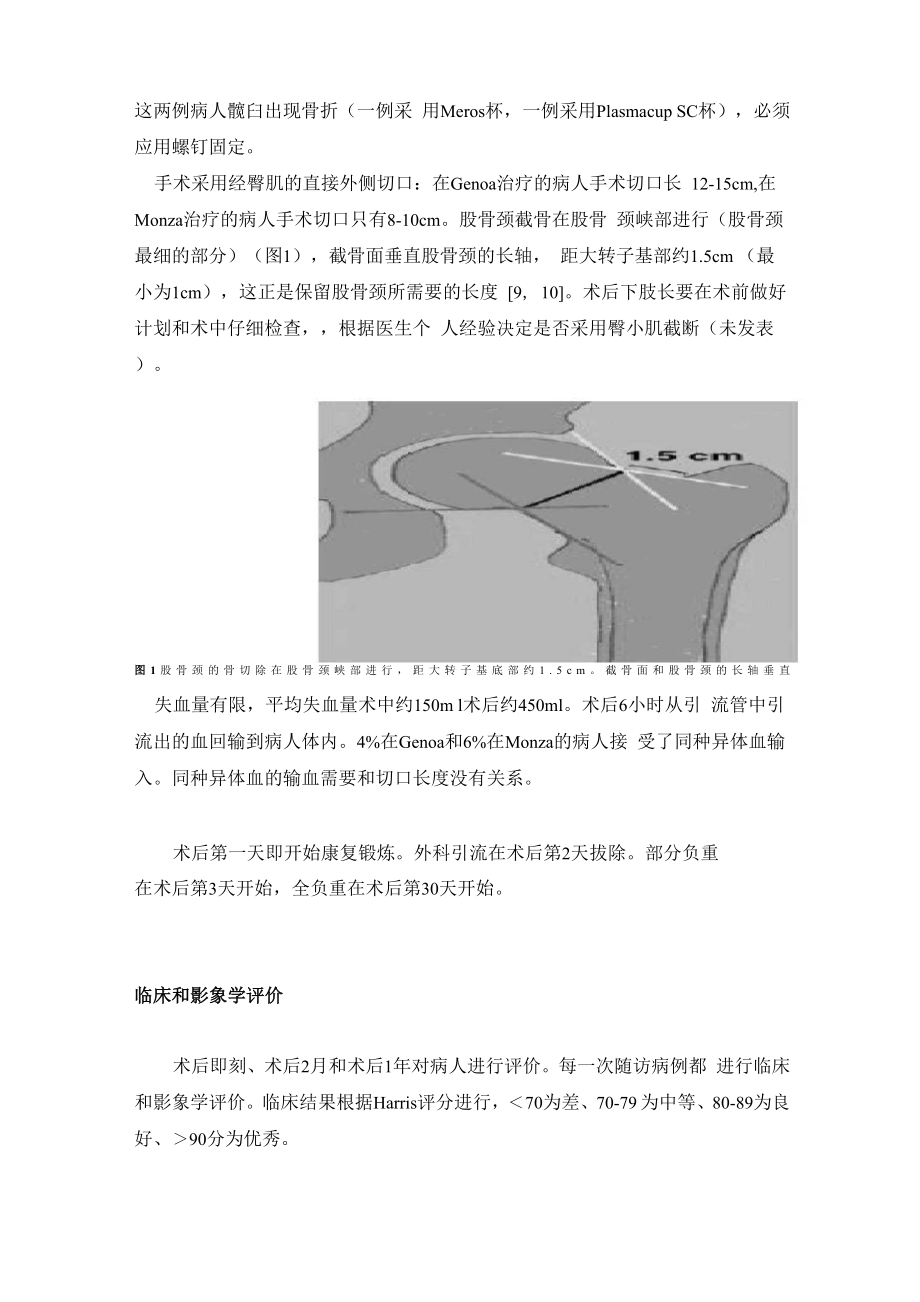 CFP 假体在微创全髋关节成形术中的应用.docx_第3页