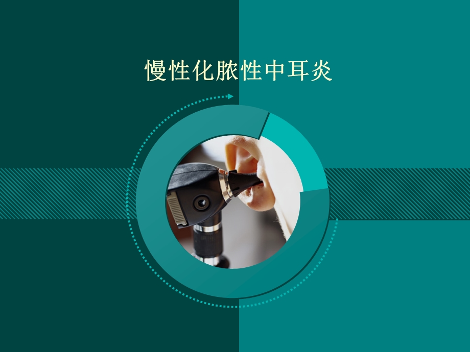 《胆脂瘤型中耳炎》PPT课件.ppt_第1页