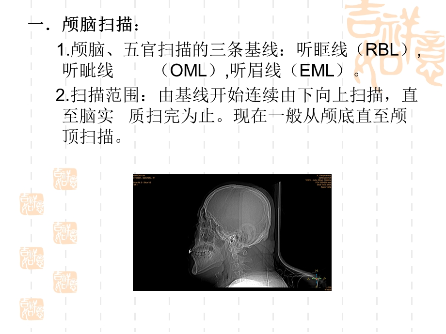 CT 扫描范围.ppt_第3页