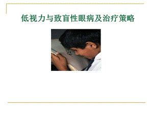 《致盲性眼病》PPT课件.ppt