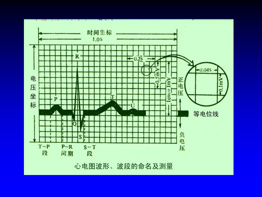 c第二节正常心电图.ppt_第2页