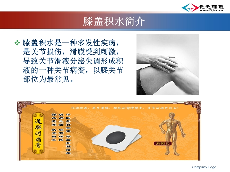 踝关节膝盖积水.ppt_第3页