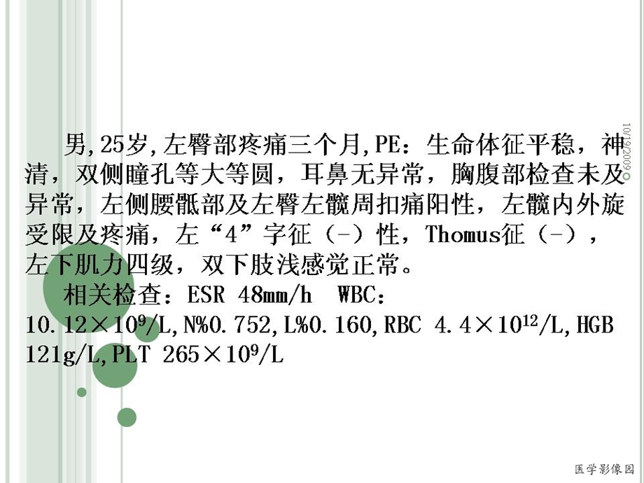 《髋骨小细胞淋巴瘤》PPT课件.ppt_第1页