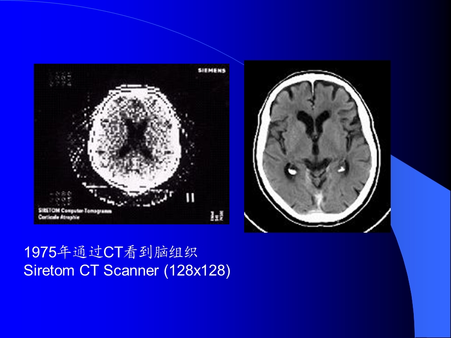 CT应用脑.ppt_第2页