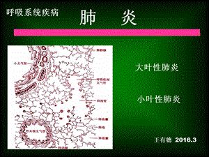 《呼吸系统疾病》ppt课件.ppt