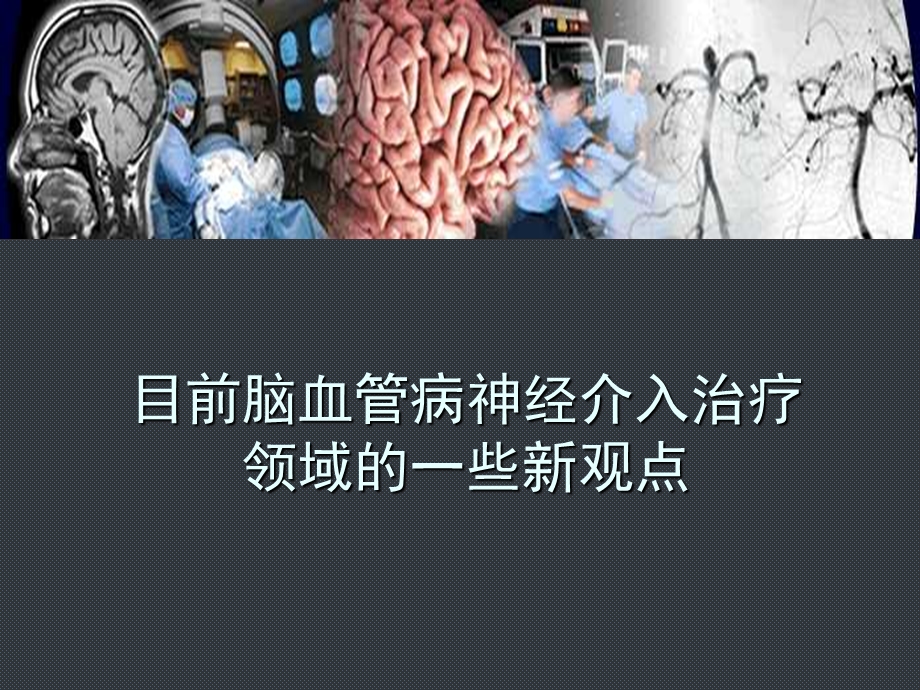 目前脑血管病神经介入治疗.ppt_第1页