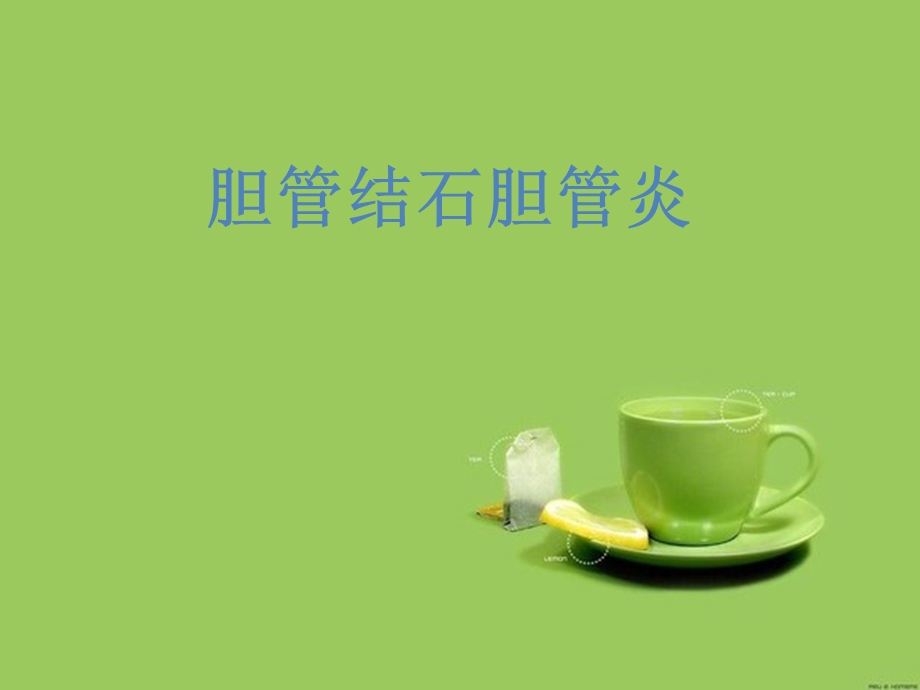 《胆管结石》PPT课件.ppt_第2页