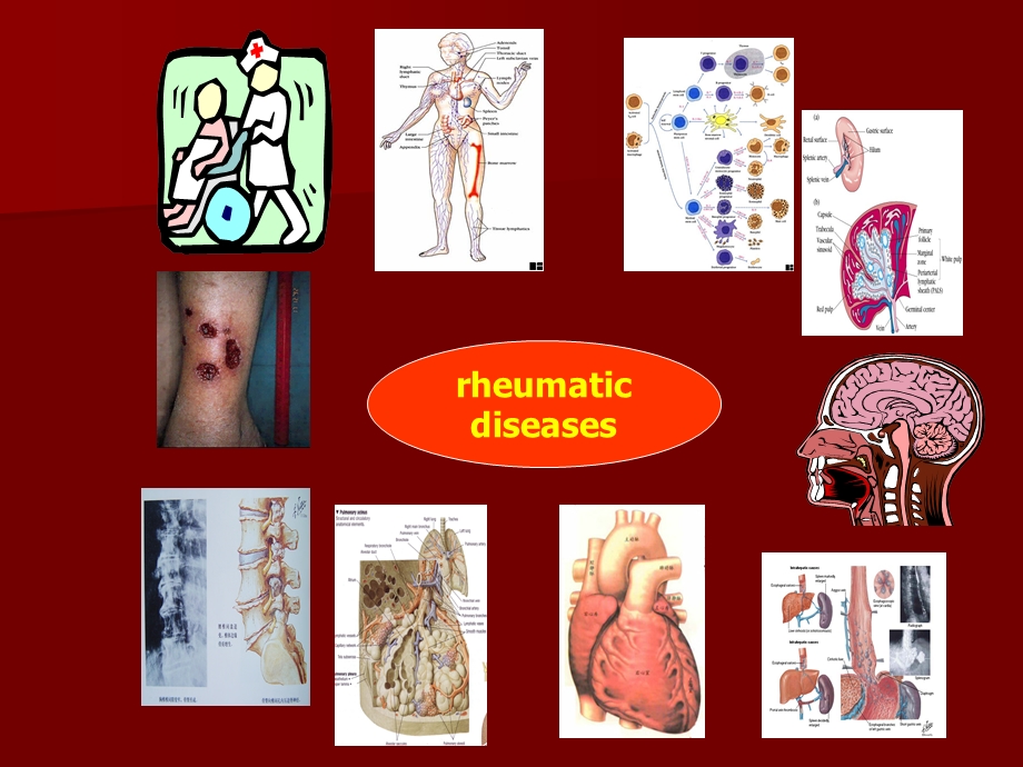 内科风湿免疫总论.ppt_第3页