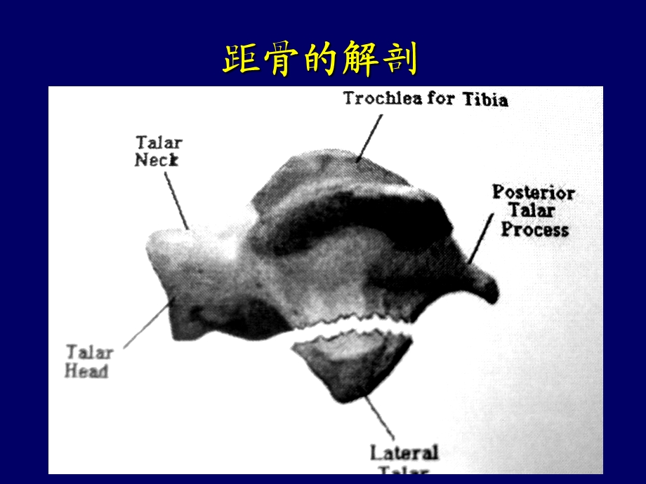 《距骨骨折》PPT课件.ppt_第3页