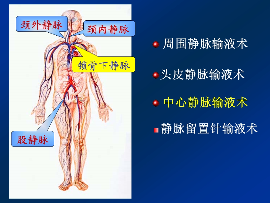 静脉输液TransfusionIntravenousInfusionIntravenousDrip.ppt_第2页