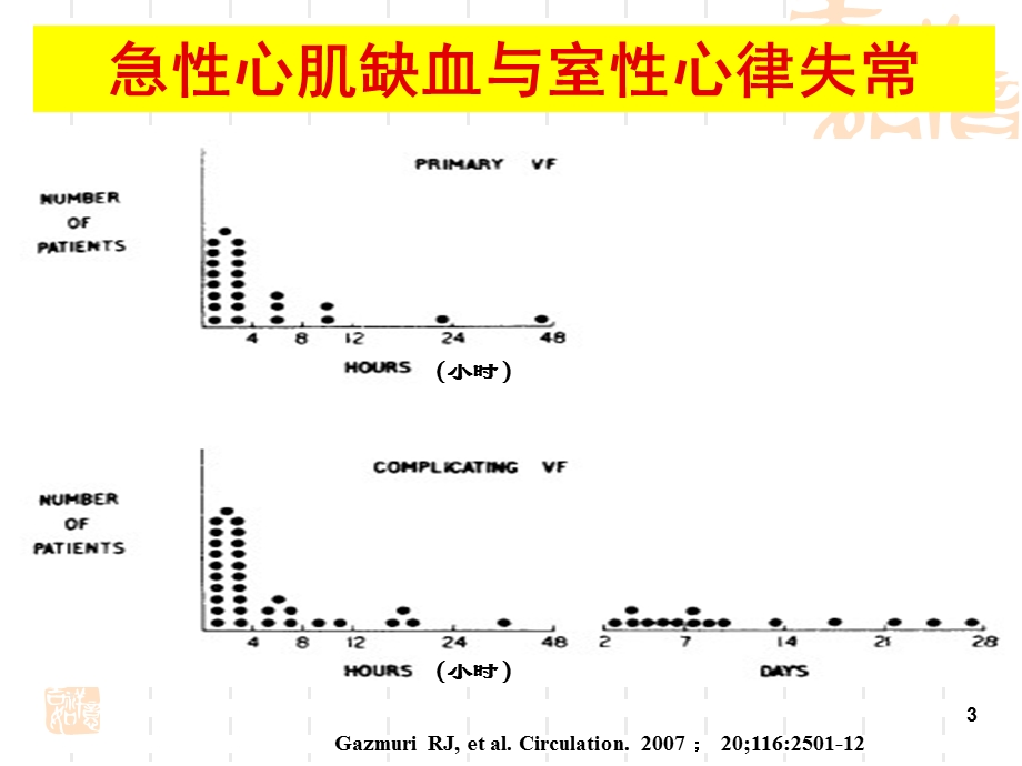 稳心颗粒缺血性室性心律失常.ppt_第3页