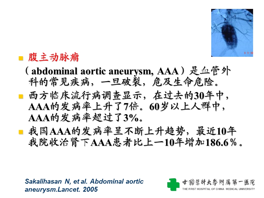 腹主动脉瘤的诊断与治疗课件.ppt_第2页