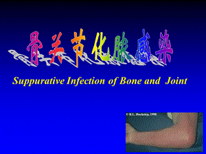 骨关节化脓感染骨关节结核.ppt