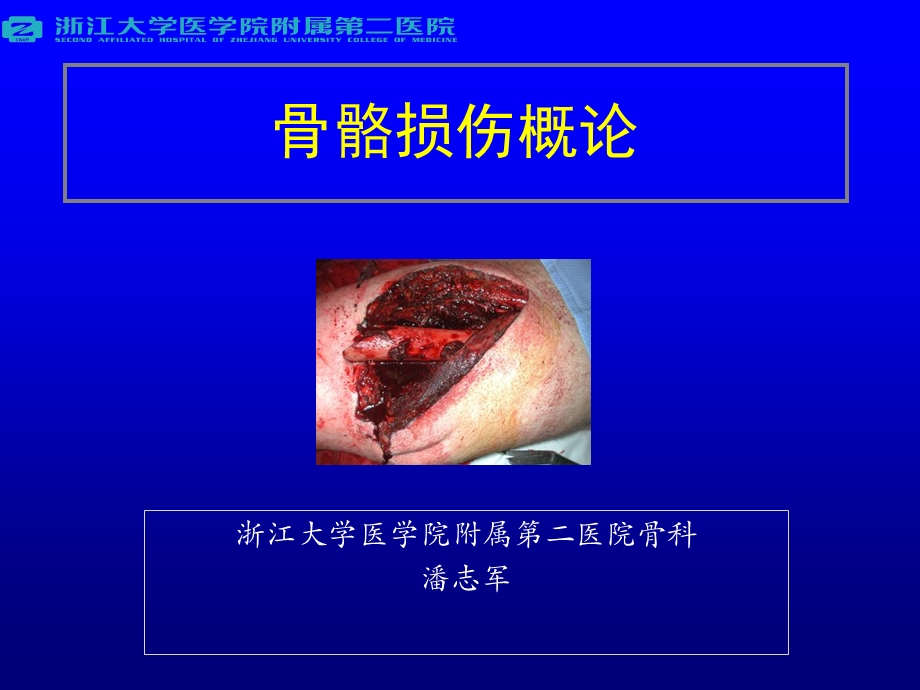 骨骼损伤概论.ppt_第1页