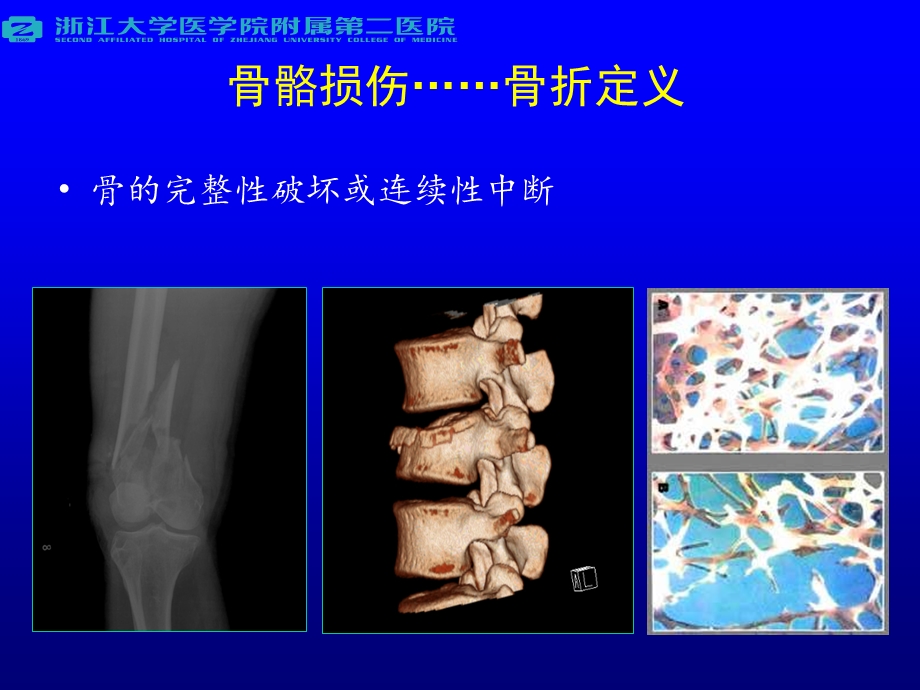 骨骼损伤概论.ppt_第2页