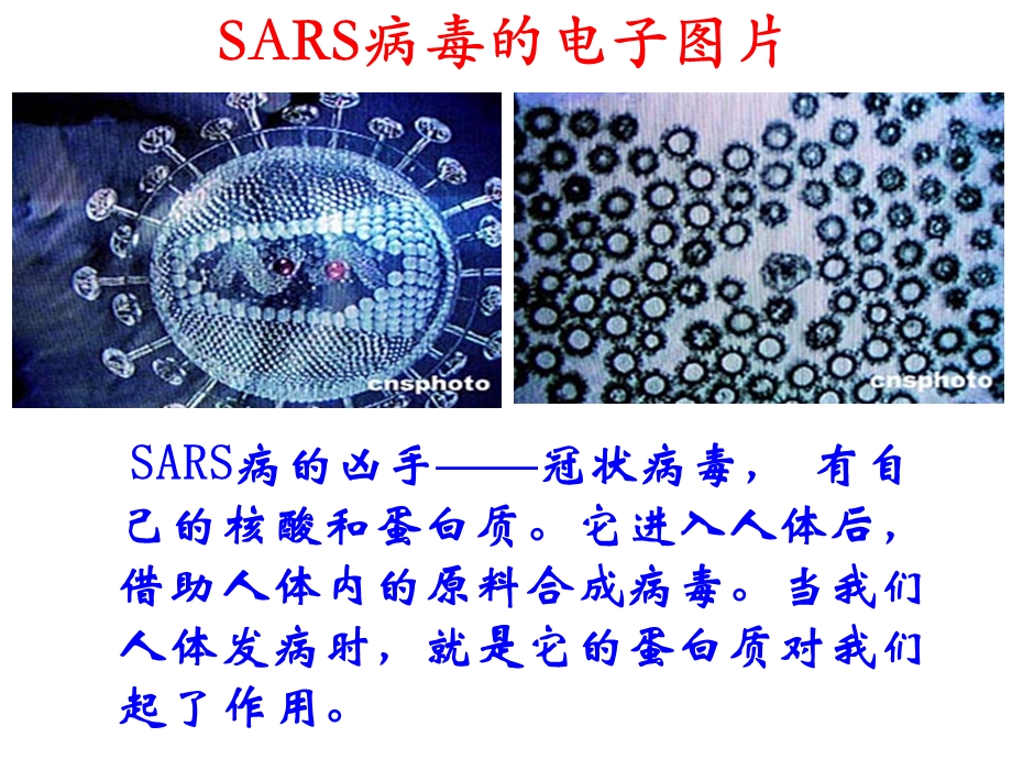 非典冠状病毒图中新社图.ppt_第3页