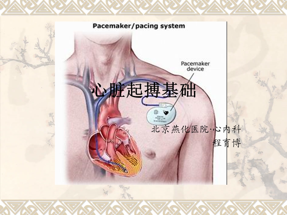 心脏起搏基础ppt课件.ppt_第1页