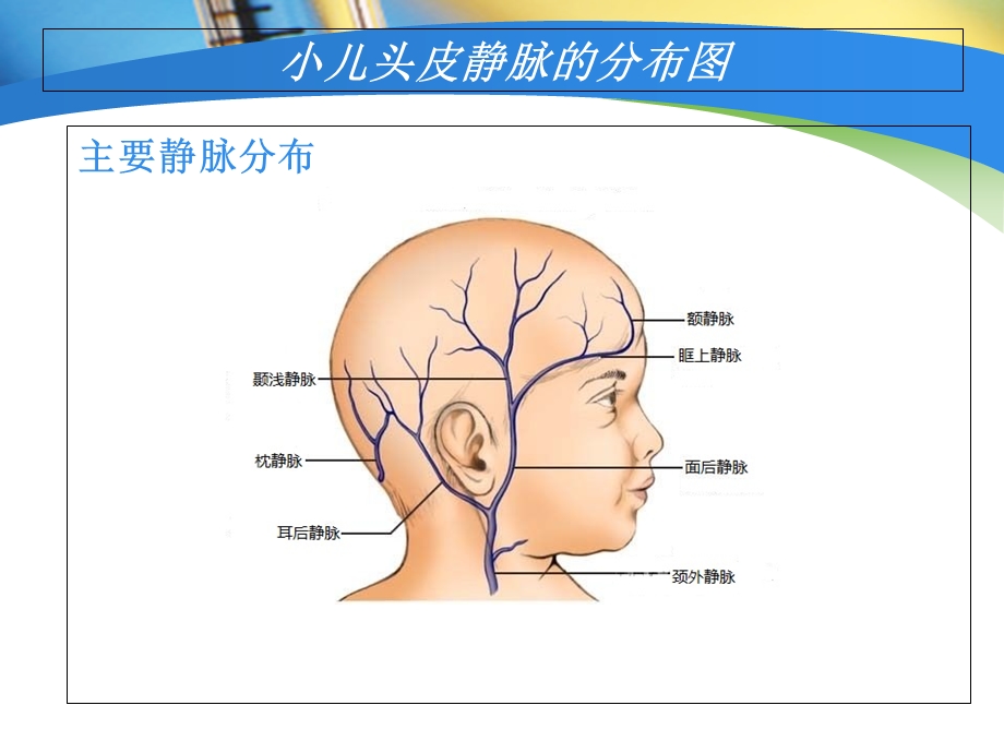 儿头皮静脉输液.ppt_第3页