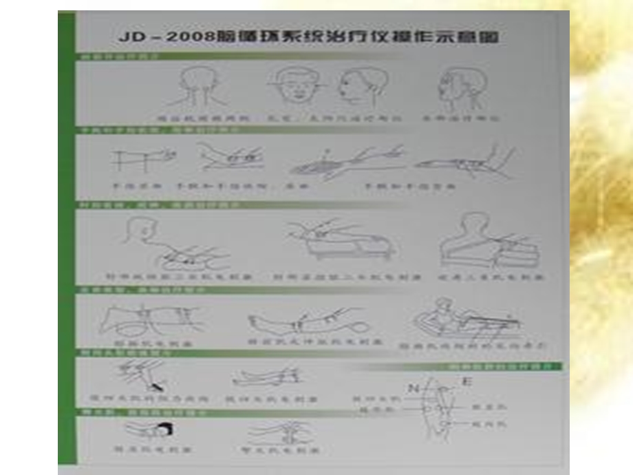 脑循环治疗仪.ppt_第3页