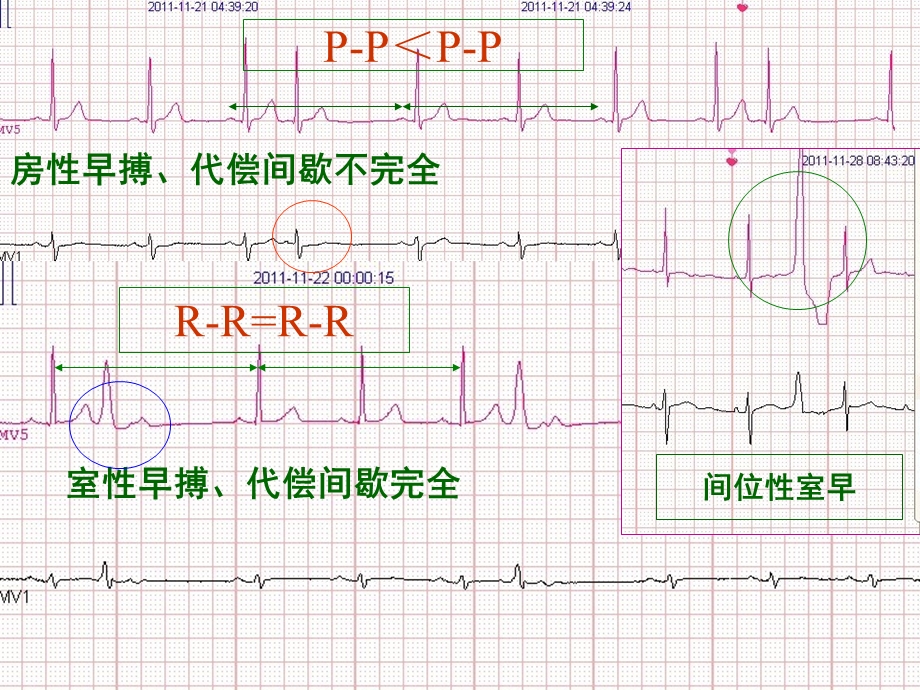 心电图讲课ppt课件.ppt_第3页