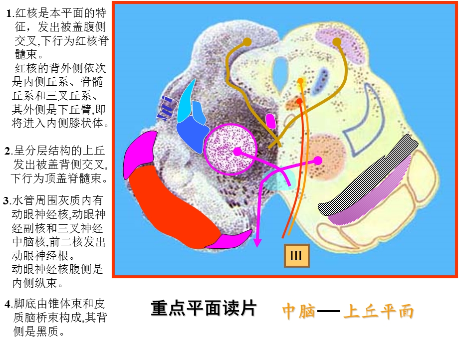 脑干网状结构小脑解剖学.ppt_第3页