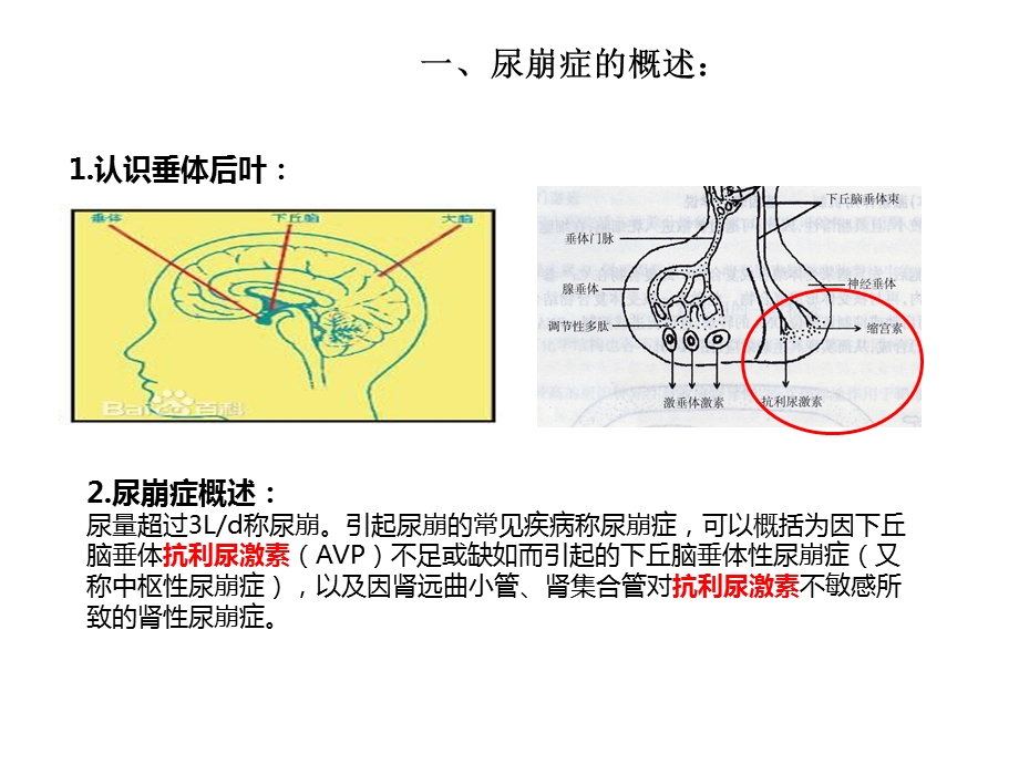 尿崩症护理查房.ppt_第3页