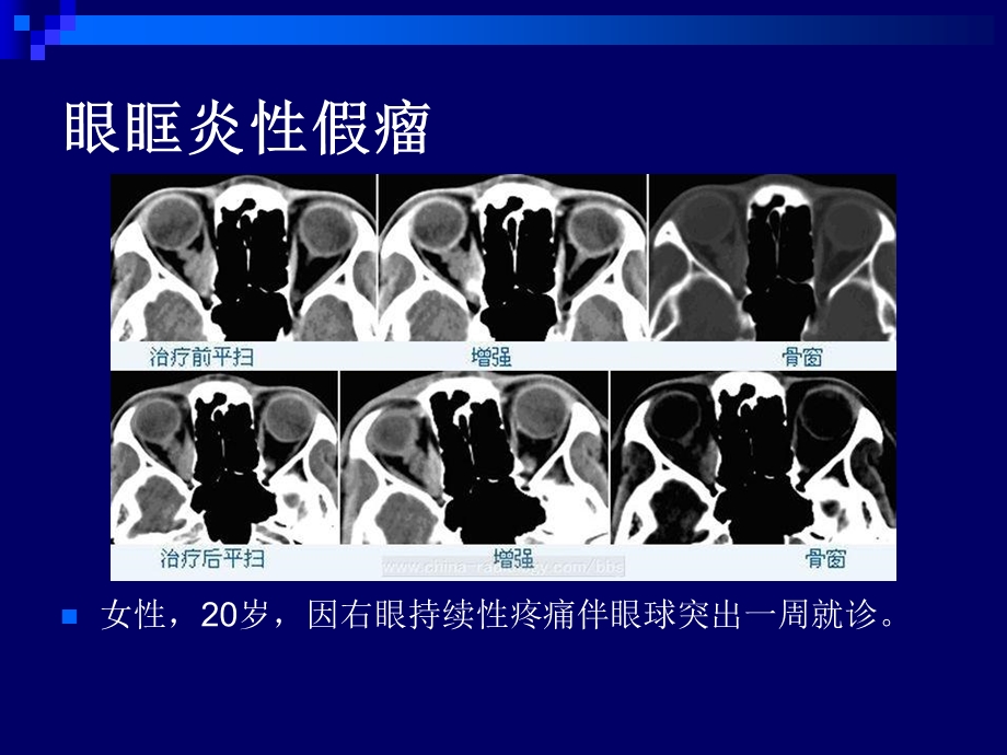 官和颈部典型病例影像读.ppt_第2页