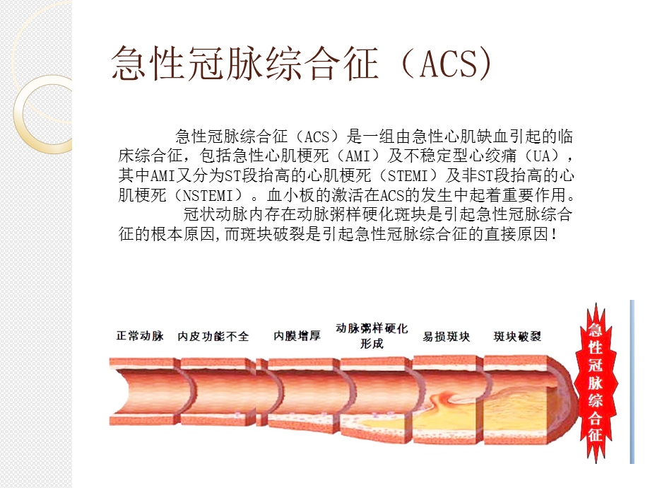 依替巴肽(埃菲替巴肽)浅谈.ppt_第3页