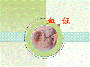 气血津液病证 血证.ppt