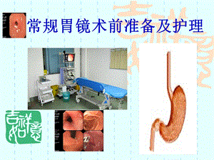 常规胃镜术前准备及护理.ppt